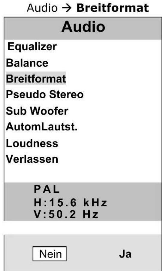 MEDION MD7223 - Equalizer - 5