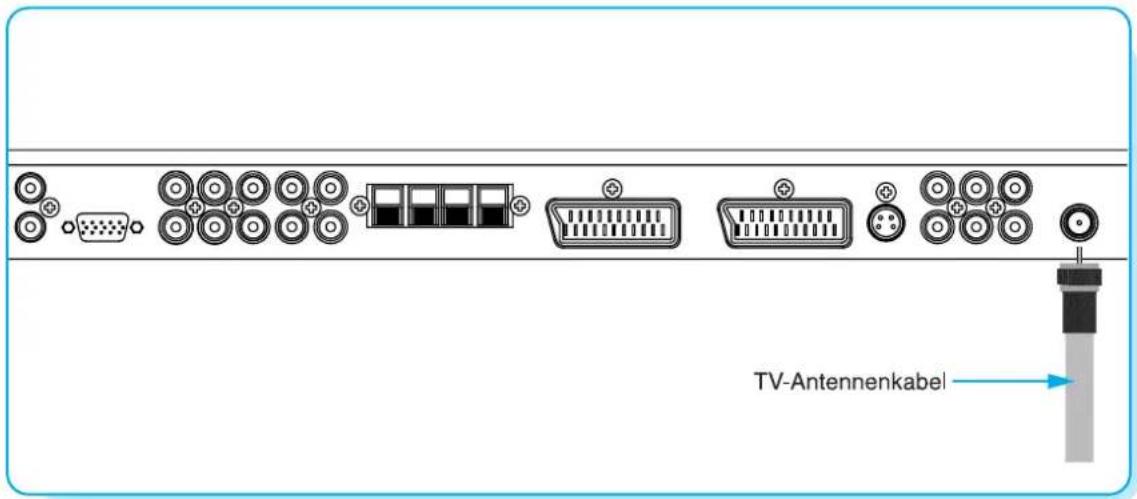 MEDION MD42555 - Fernsehen - 1