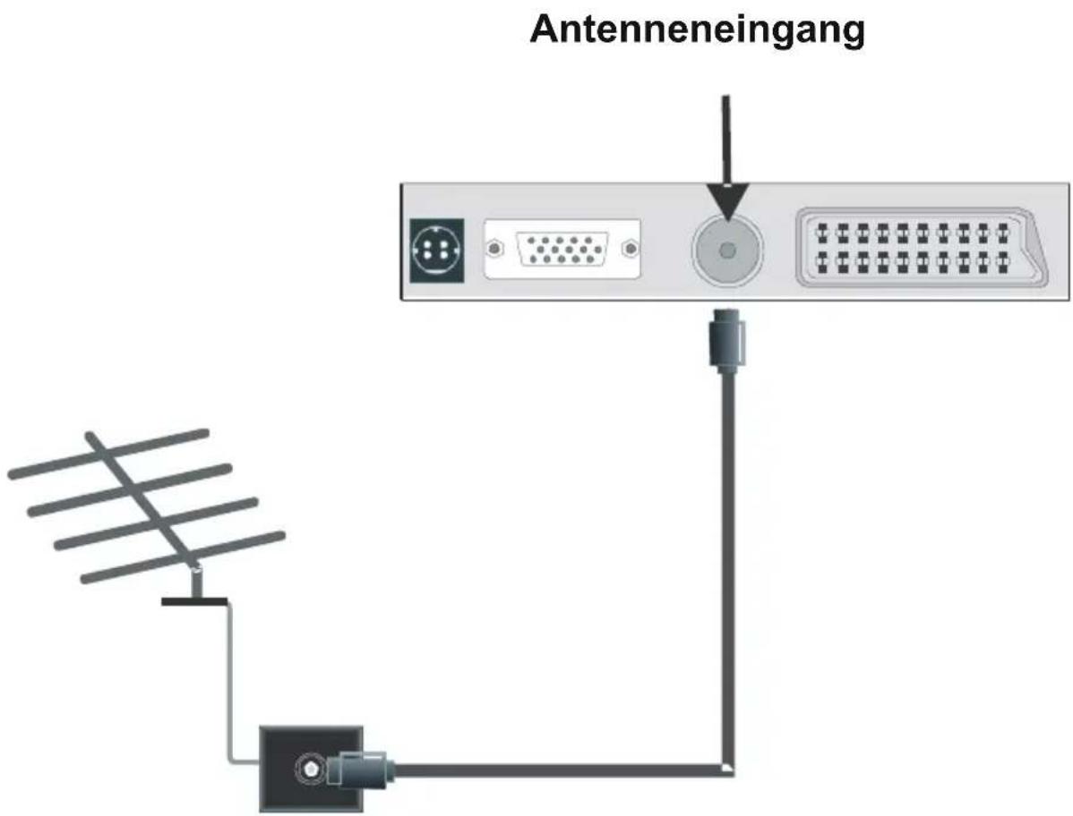 MEDION MD20031 - Antennenanschluss - 1