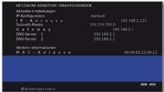 LOEWE Connect 32 3D - Konfiguration des eingebauten LAN-Adapters - 1