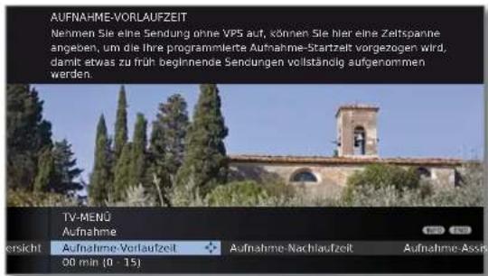 LOEWE Connect 32 3D - Aufnahme-Vorlauf- und -Nachlaufzeit einstellen - 3