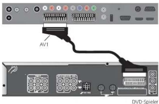 LOEWE ART 32 SL - DVD-Spieler an das TV-Gerät anschließen - 1