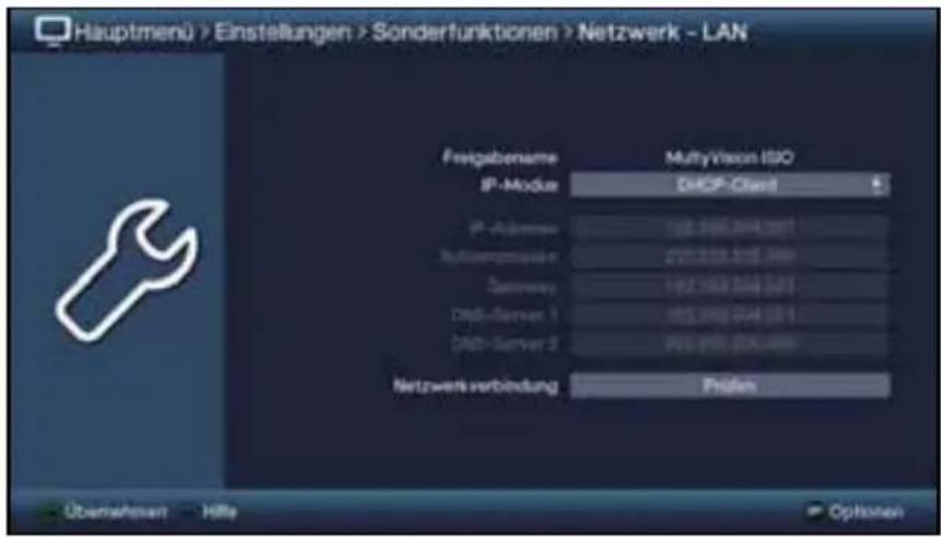 Hauptmenü > Einstellungen > Sonderfunktionen > Netzwerk - LAN Frigabenome MultiVision ISO IP-Module DHCP Client P-Adapter 102.196.044.041 Rutterungsplan 201.238.515.399 Sensions 192.196.044.041 DNS-Server 1 192.196.044.041 DNS-Server 2 192.196.044.041 Netzwerk verbindung Progen Überwehen - Hille Options