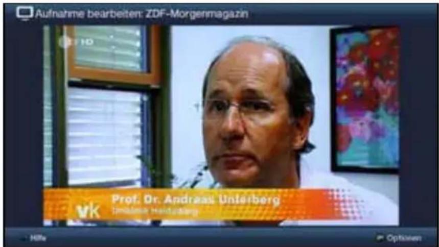 Aufnahme bearbeiten: ZDF-Morgenmagazin Prof. Dr. Andreas Unterberg vk Imalase Heiduzlang Hills Optivaen