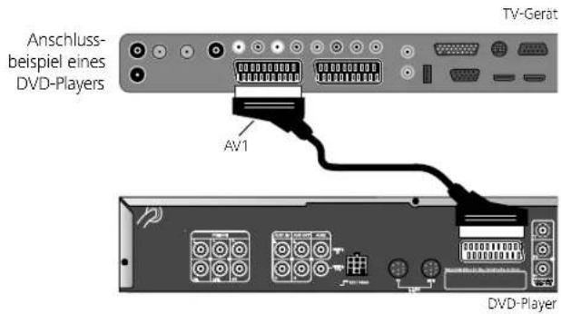 LOEWE Xelos A 37 HD 100 - DVD-Player an das TV-Gerät anschließen - 1