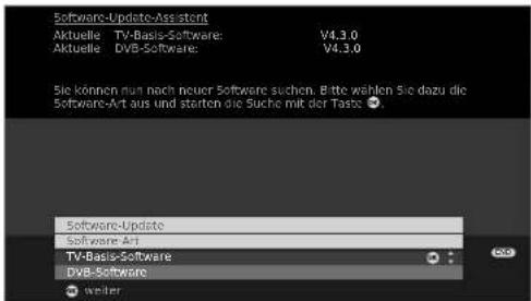 LOEWE Xelos A 37 HD 100 - DVB - 2