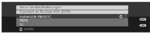 LOEWE Xelos A 37 HD 100 - Signalart - 1