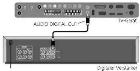 LOEWE Xelos A 32 HD 100 - Digitale Audio-Verstärker anschließen - 1