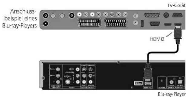 LOEWE Xelos A 32 HD 100 - Gerät anschließen - 1