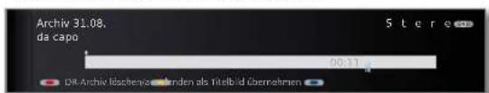LOEWE Individual 55 Compose LED 400 - Titelbild festlegen ^(1) - 3