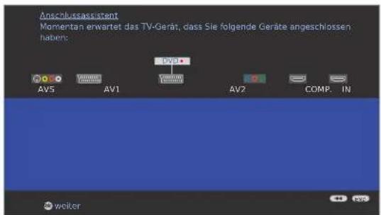 LOEWE Individual 46 selection Full HD 100 - Anschlussassistent - 4