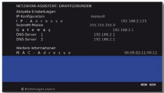 LOEWE Individual 46 Compose LED 400 - Konfiguration des eingebauten LAN-Adapters - 1