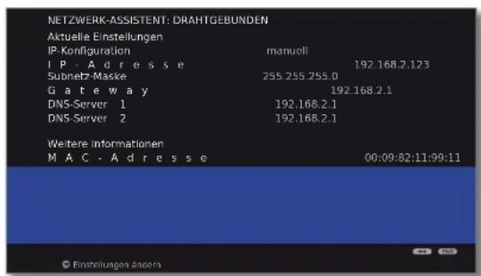 LOEWE Individual 46 Selection LED 200 - Konfiguration des eingebauten LAN-Adapters - 1
