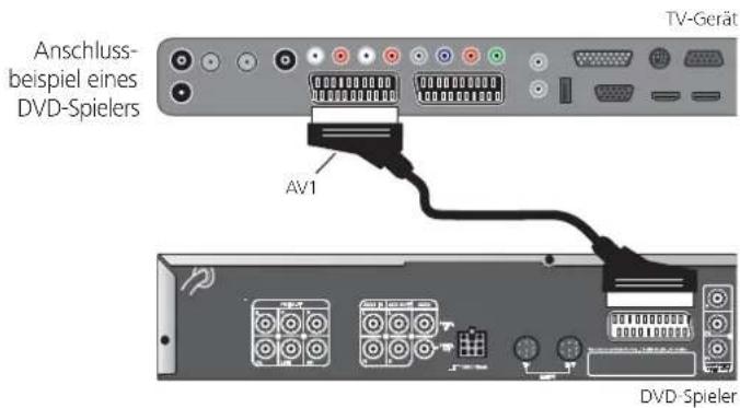 LOEWE Individual 46 Compose 100 - DVD-Spieler an das TV-Gerät anschließen - 1