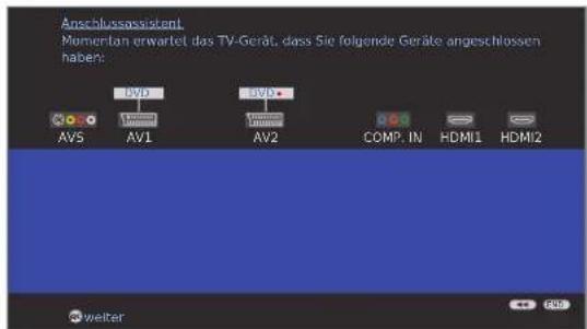 LOEWE Individual 40 Compose Full HD 100 - Anschluss weiterer Geräte an das TV-Gerät - 5
