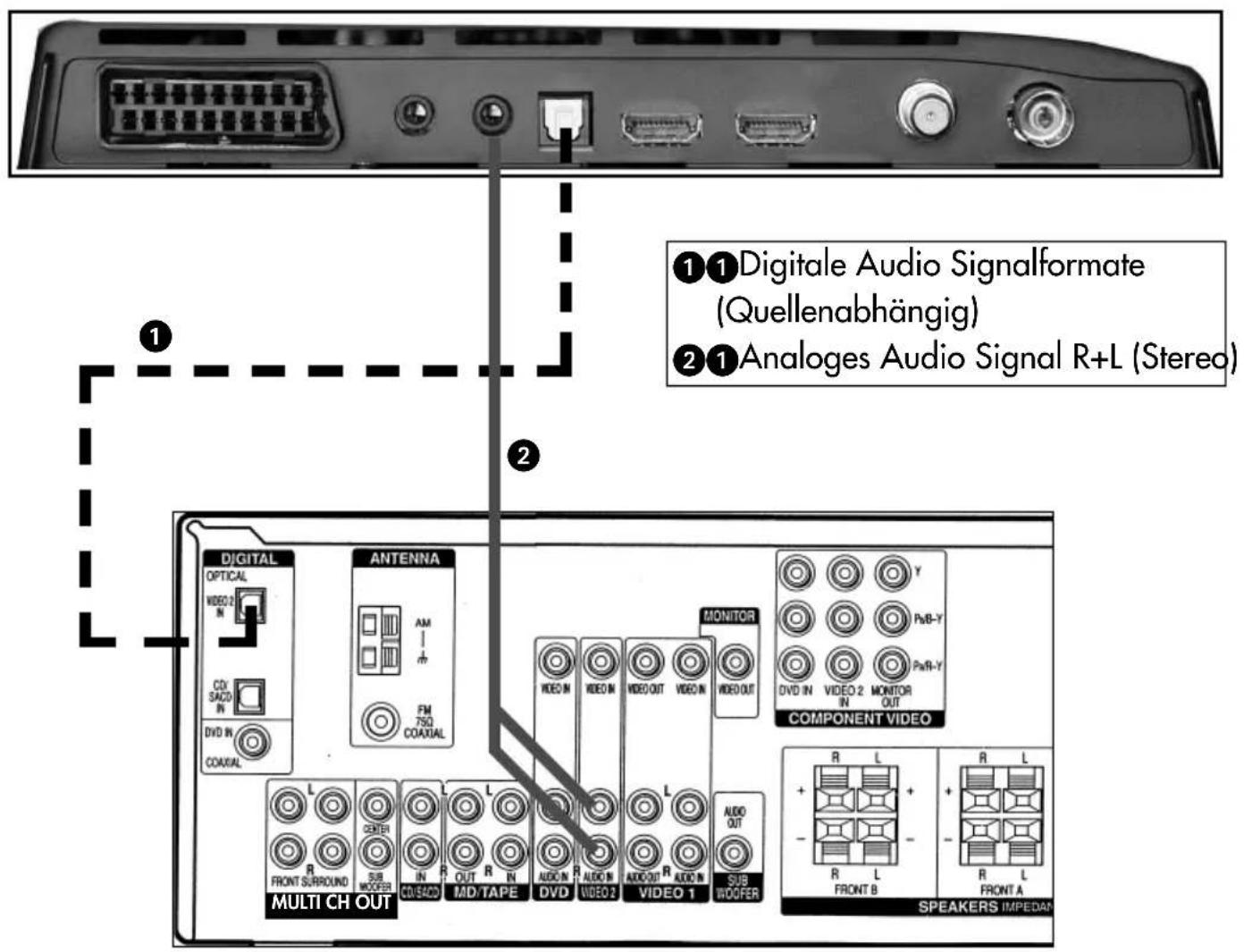 METZ Linea FHDTV 100 - Tonwiedergabe - 1