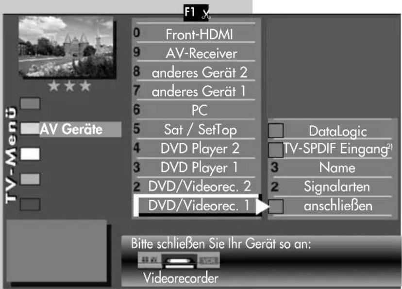 METZ Chorus - AV Gerät am TV-Gerät abmelden bzw. entfernen - 1