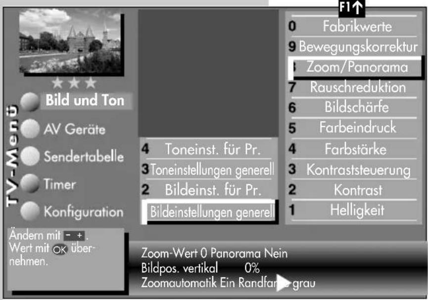 METZ Carat 32-70 - Bildeinstellungen generell - 4