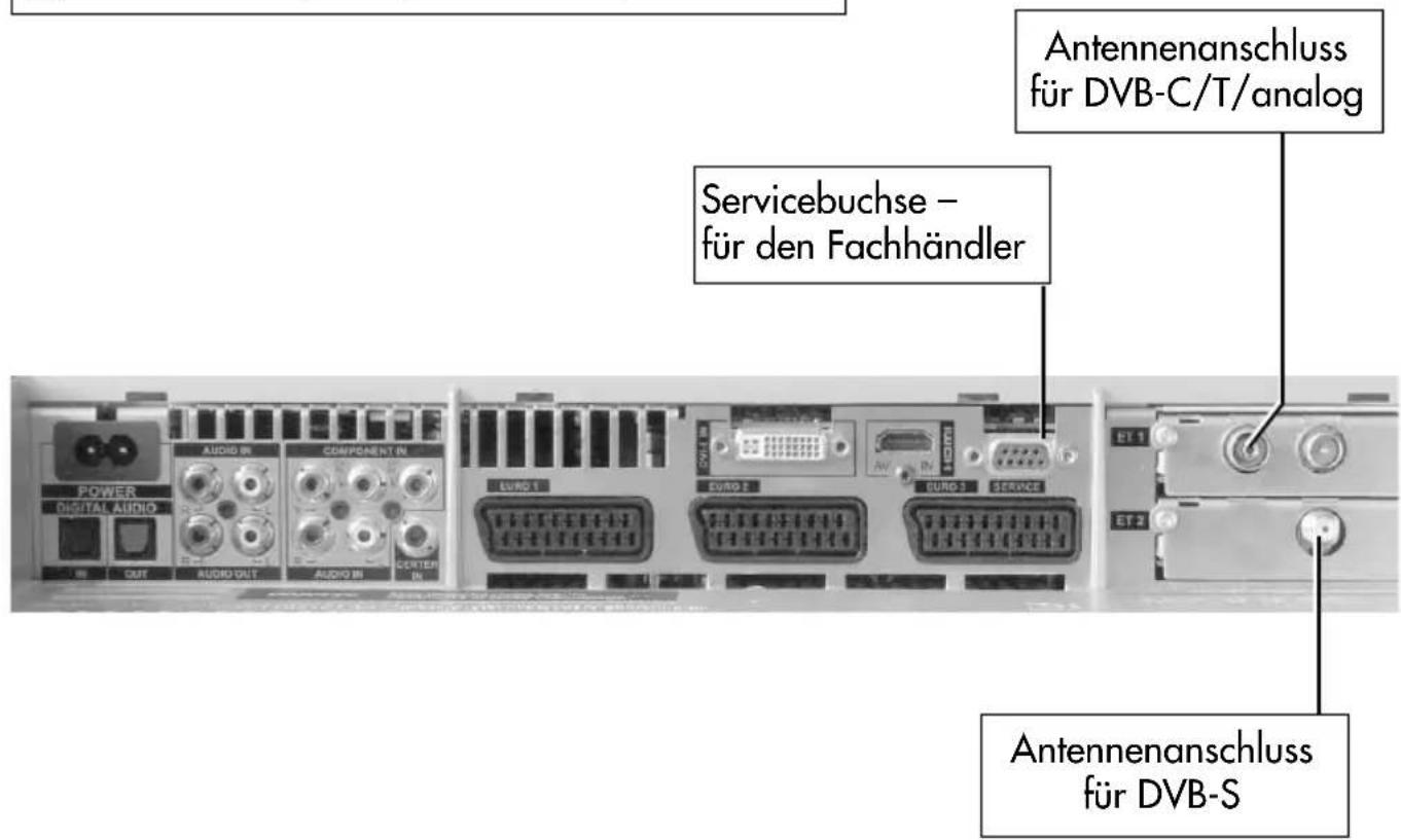METZ Carat 32-70 - Anschlussmöglichkeiten vorne - 2