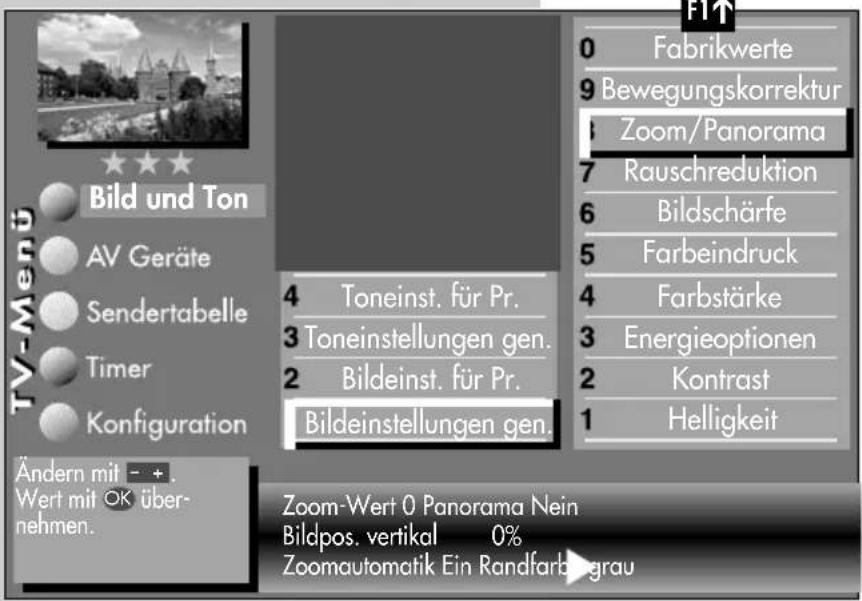 METZ Linus 32 HDTV 100 - Bildeinstellungen generell - 5