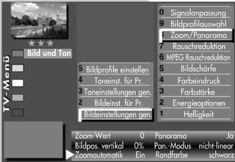 METZ Axio pro - Zoomautomatik einstellen - 1