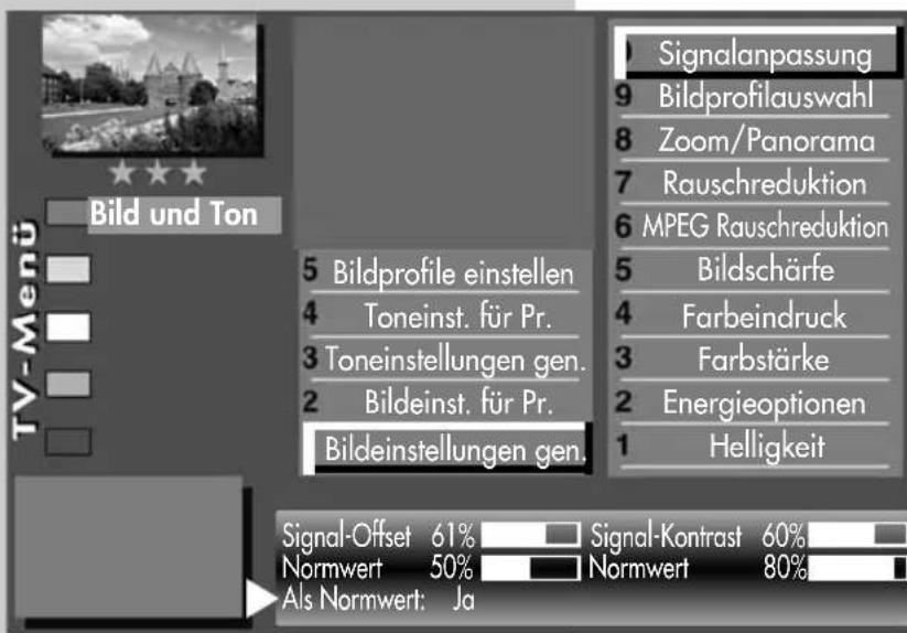 METZ Sirius - Bildeinstellungen generell Signalanpassung - 2