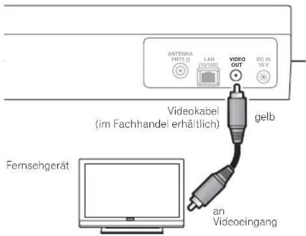 ANTENNA FM73 [J] LAN (10/100) VIDEO OUT DC IN 19 V Videokabel (im Fachhandel erhältlich) gelb Fernsehgerät an Videoeingang