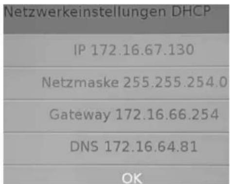 XORO HRK 8760 CI+ - DLNA - 5