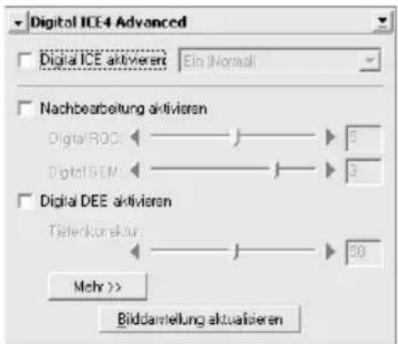 Digital ICE Advanced Digital ICE aktivieren Ein Normal Nachbearbeitung aktivieren Digital RDC: 5 Digital SEM: 3 Digital DEE aktivieren Tiefenkonskur: 50 Mehr >> Bildartstellung aktualisieren