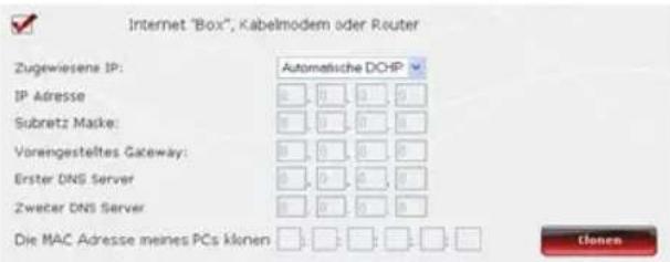 Internet "Box", Kabelmodem oder Router Zugewiesene IP: IP Adresse Subretz Maske: Varengesteltes Gateway: Erster DNS Server Zweer DNS Server Die MAC Adresse meines PCs klonen Automatische DCHP Elenen
