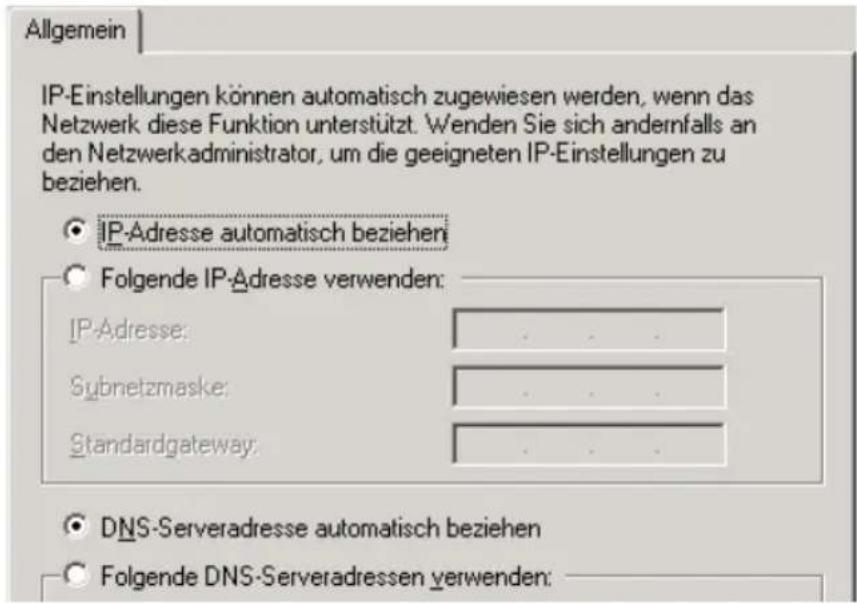 AVM FRITZ!Box Fon ata - IP-Adresse automatisch beziehen in Windows 2000 - 2