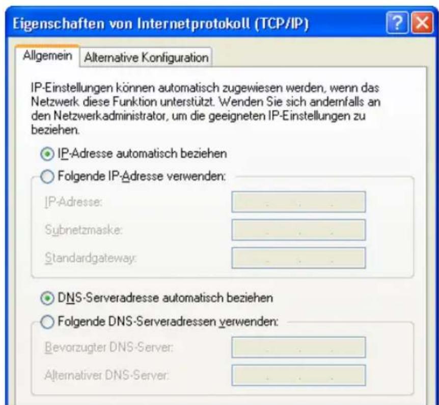 AVM FRITZ!Box Fon ata - IP-Adresse automatisch beziehen in Windows XP - 1