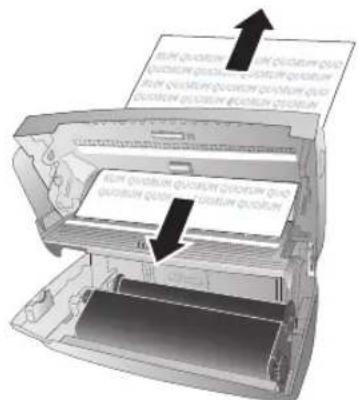 PHILIPS PPF 632 - Dokumentenstau beheben - 3