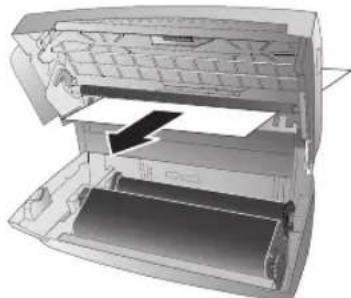 PHILIPS PPF 632 - Papierstau beheben - 2