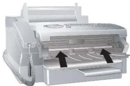 PHILIPS Laserfax 855 - Reinigung - 1