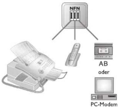 NFN AB oder PC-Modem