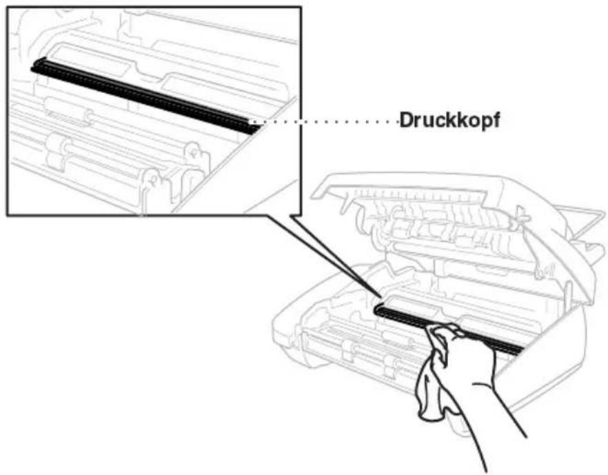 Druckkopf