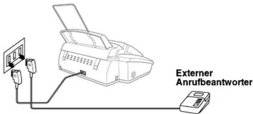 Externer Anrufbeantworter