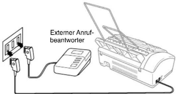 Externer Anruf- beantwörter