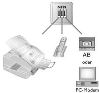 NFN AB oder PC-Modem