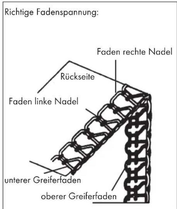 SILVERCREST KH 4300 - Fadenspannung - 2