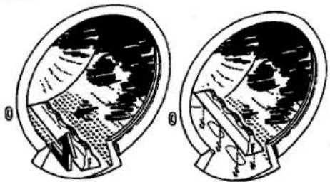 ASKO 20004 - Cleaning holes under the washing blades - 1