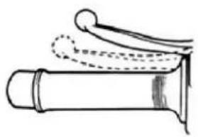 Saro SC 50 - Bremshebel (Hinterradbremse) Feststellbremse - 1