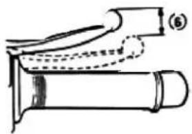 Saro SC 50 - Bremshebel (Vorderradbremse) - 1