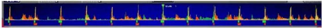 HERCULES VirtualDJ DJC MP3 e2 - e) Waveformbereich - 1