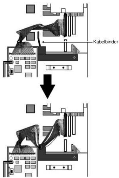 Kabelbinder