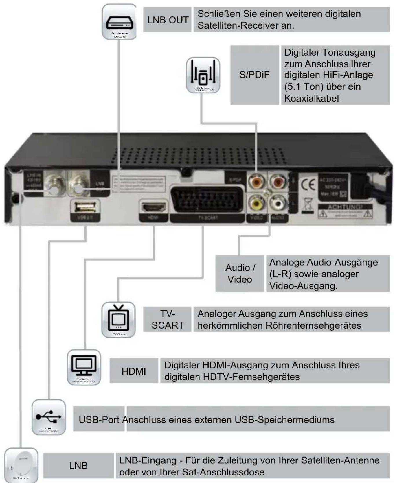 SetOne Easy One HX 60 HDplus - Übersicht der Anschlussmöglichkeiten - 1