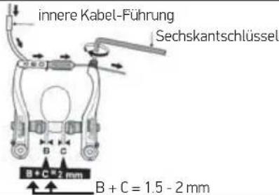 IDEAL Bump - Bremssysteme - 1