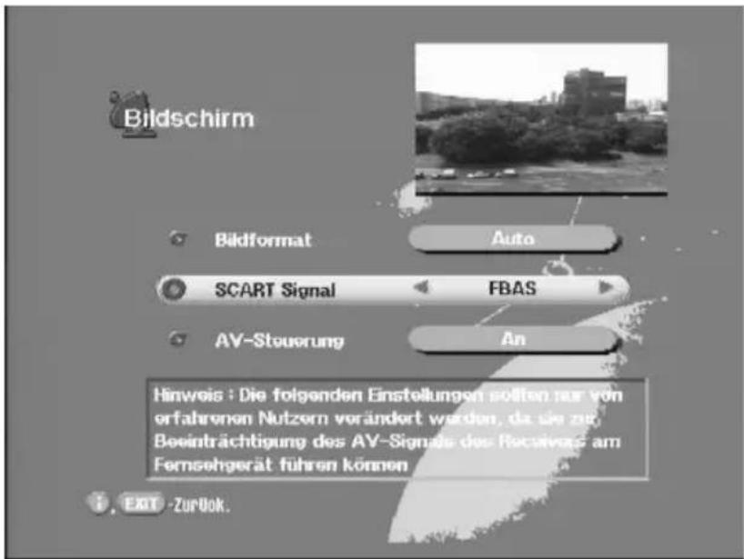 KATHREIN UFD 590 - Bildschirm - 1