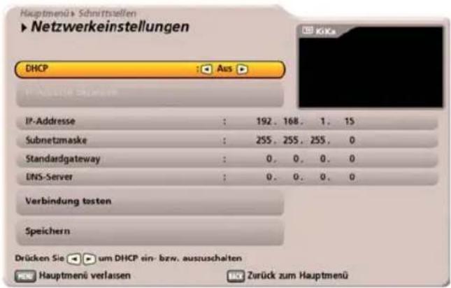 KATHREIN UFC 960 - DHCP „Aus“ (Hub/Switch/Direkte Verbindung zu PC oder Laptop) - 3